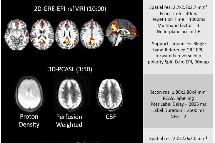 PREDICTOM Launches Standardized MRI Protocol to Detect Early Alzheimer’s Risk